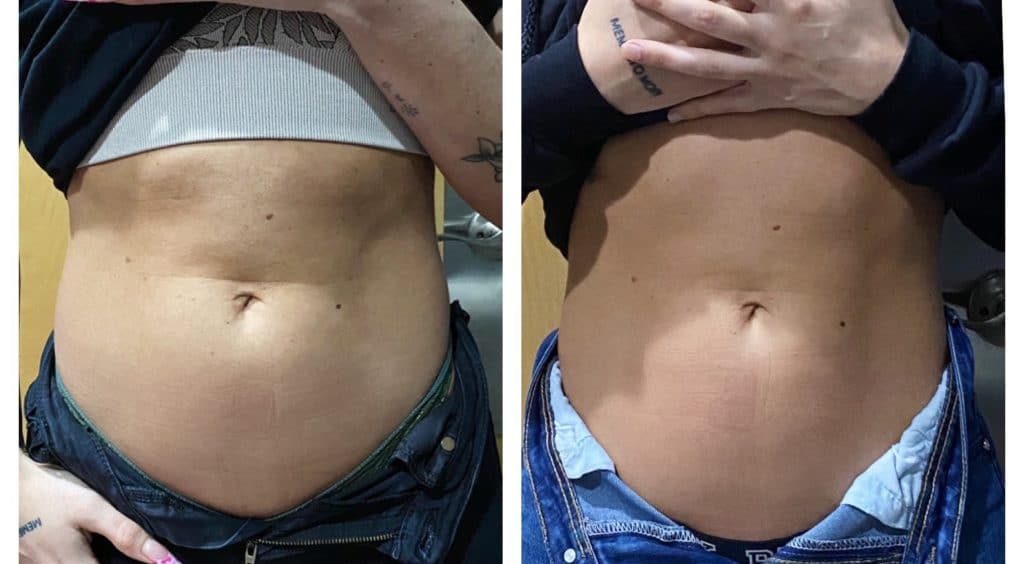 Fitwave - Sculpt Your Body and Build Muscle, Before and After.